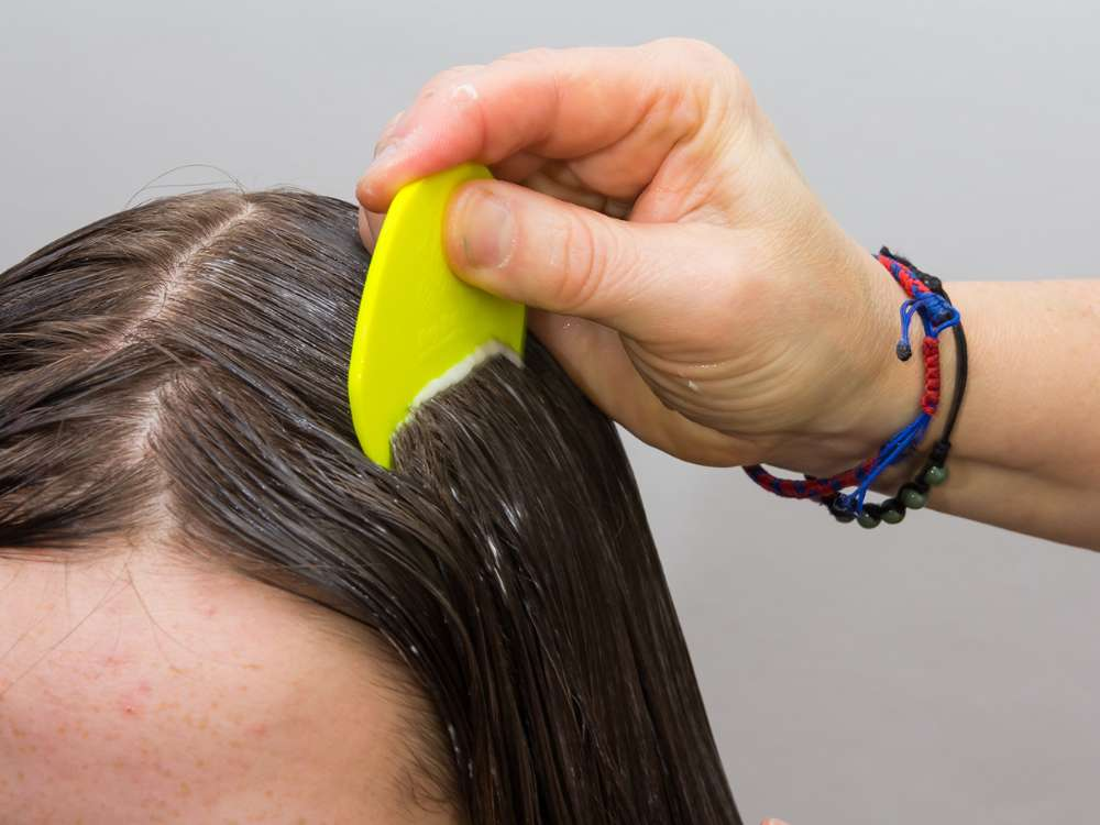 How to Spot and Treat Head Lice in Kids Scholastic Parents