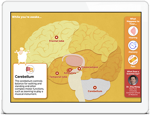 iPad showing Brain Activity